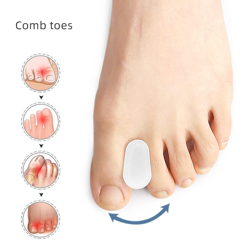 Toe Separator Silicon - ที่แยกนิ้วเท้ารูปตัว I 1/2/3/4 คู่ เจลแยกนิ้วเท้า ที่แก้ไขนิ้วเท้า