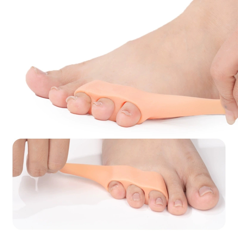 อุปกรณ์แก้ไขนิ้วหัวแม่เท้าโก่ง - Toe Separator Silicon บทวิจารณ์และราคา