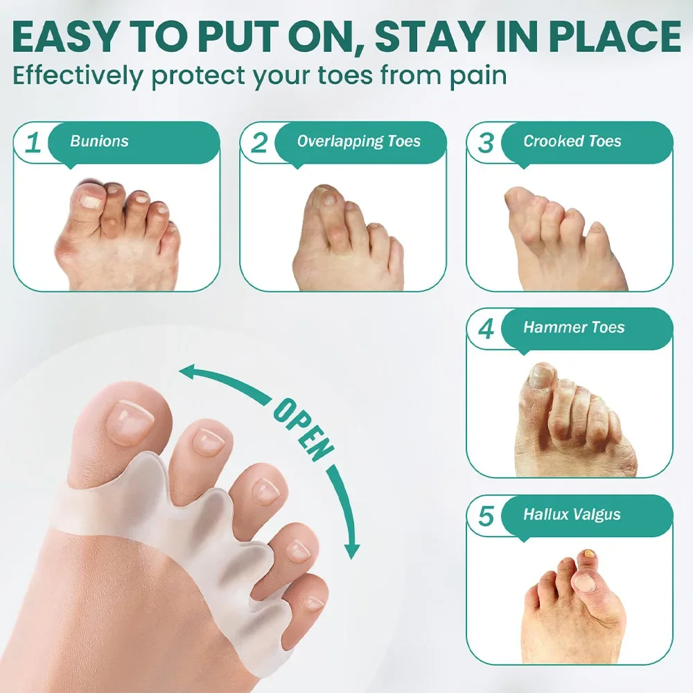 ตัวแยกนิ้วเท้าซิลิโคนแบบใช้ซ้ำ - Toe Separator Silicon บทวิจารณ์และราคา