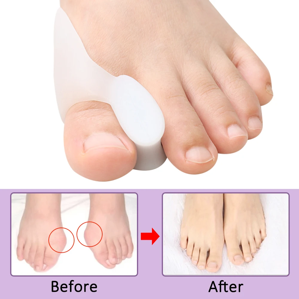 เจลรองนิ้วเท้า 2/4/8 ชิ้น สำหร - Toe Separator Silicon บทวิจารณ์และราคา