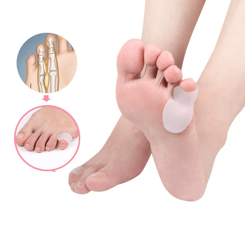 อุปกรณ์ป้องกันนิ้วก้อย 1/2/5 ค - Toe Separator Silicon บทวิจารณ์และราคา
