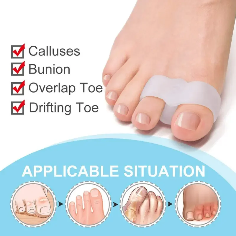 Bunion Corrector 1 คู่ - เครื่ - Toe Separator Silicon บทวิจารณ์และราคา