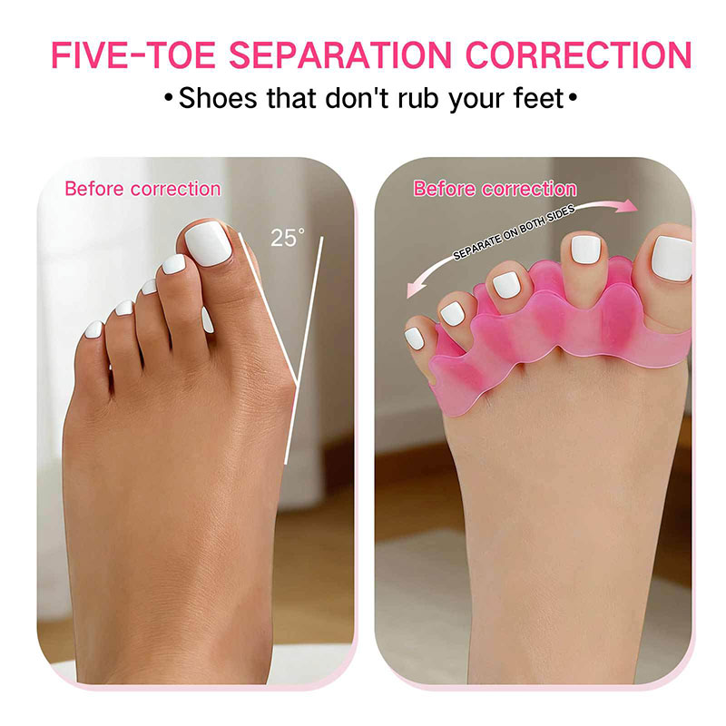 แผ่นซิลิโคนแยกนิ้วเท้า 1 คู่ ส - Toe Separator Silicon บทวิจารณ์และราคา