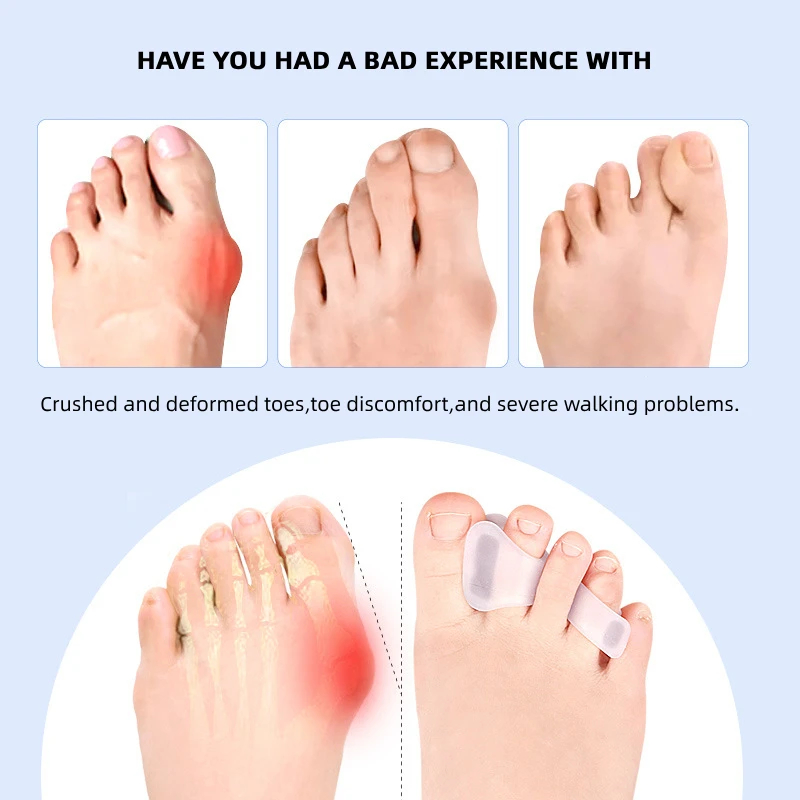 อุปกรณ์แก้ไขนิ้วหัวแม่เท้าเก 1 - Toe Separator Silicon บทวิจารณ์และราคา